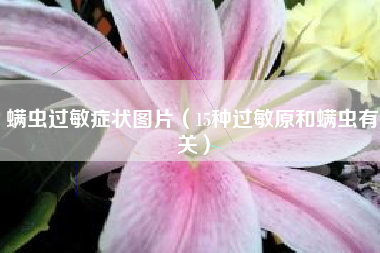 螨虫过敏症状图片(15种过敏原和螨虫有关)