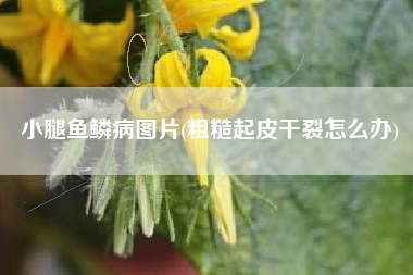 小腿鱼鳞病图片(粗糙起皮干裂怎么办)