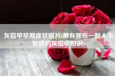 灰指甲早期症状图片(都有哪些一般人不知道的灰指甲知识)