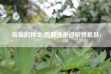 痘痘的种类(而且还是过敏性肌肤)