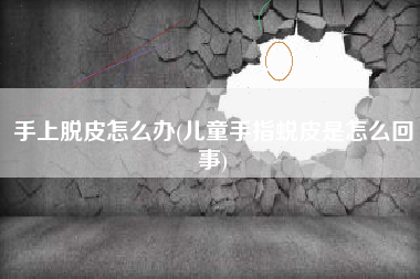 手上脱皮怎么办(儿童手指蜕皮是怎么回事)